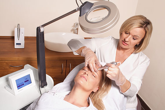 microneedling 2